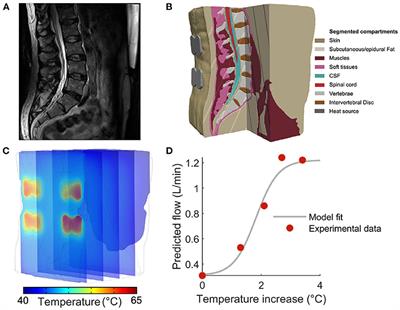 Computational Modeling of Deep Tissue Heating by an Automatic Thermal Massage Bed: Predicting the Effects on Circulation